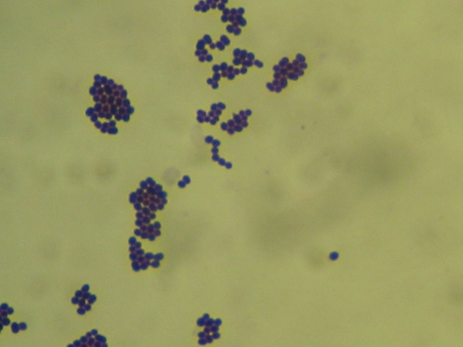 <i >Staphylococcus aureus</i> grampositivo, aves de producción