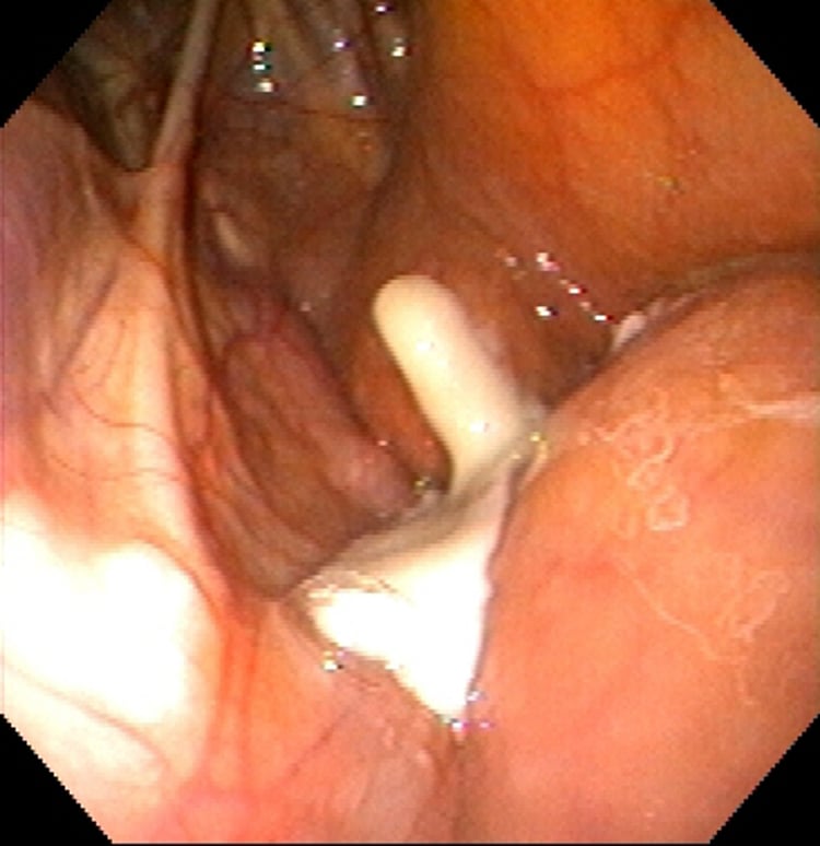 Guttural pouch empyema, horse