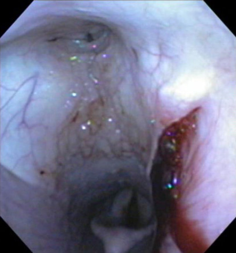 Guttural pouch mycosis, horse