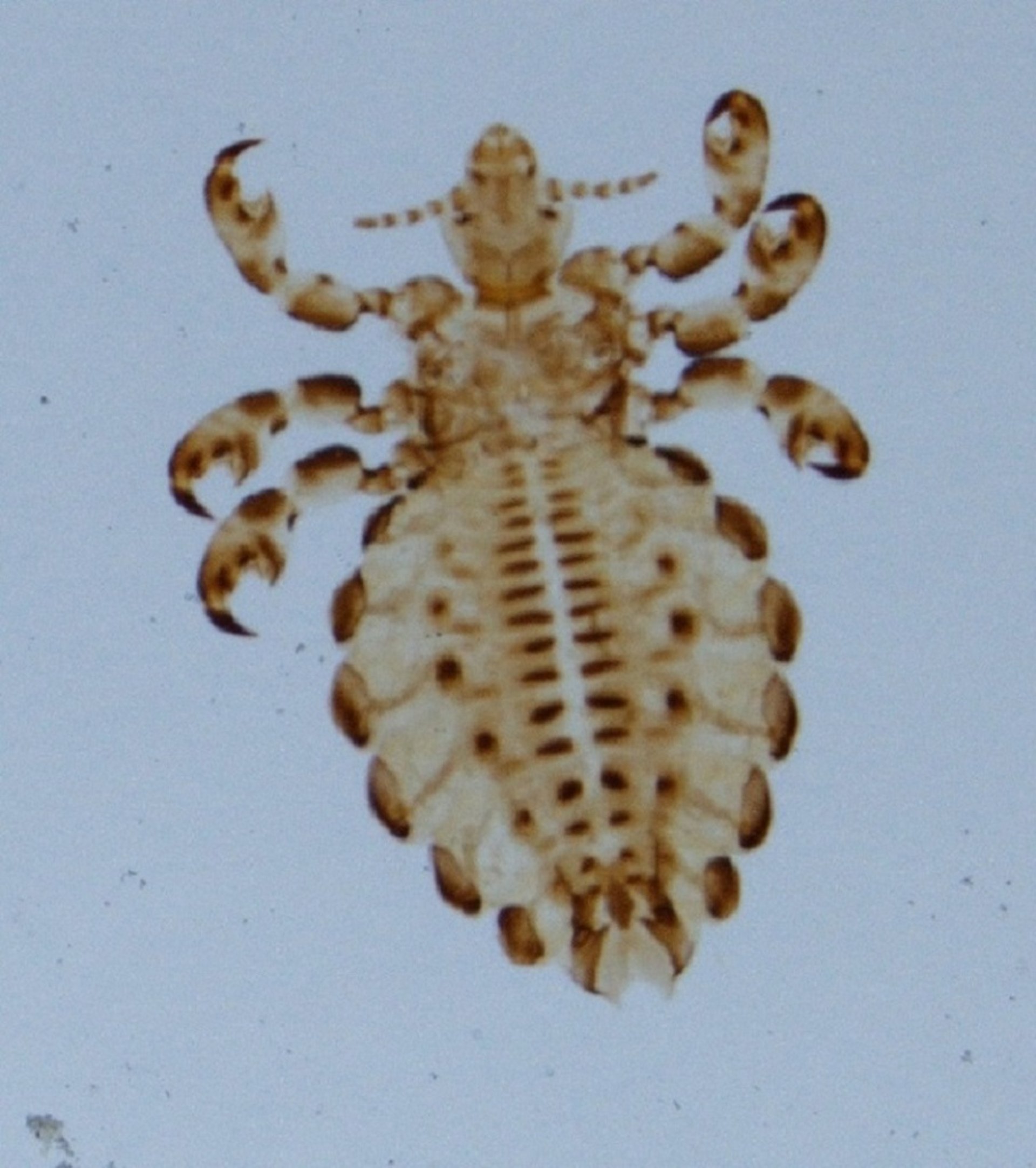 <i >Haematopinus eurysternus</i>