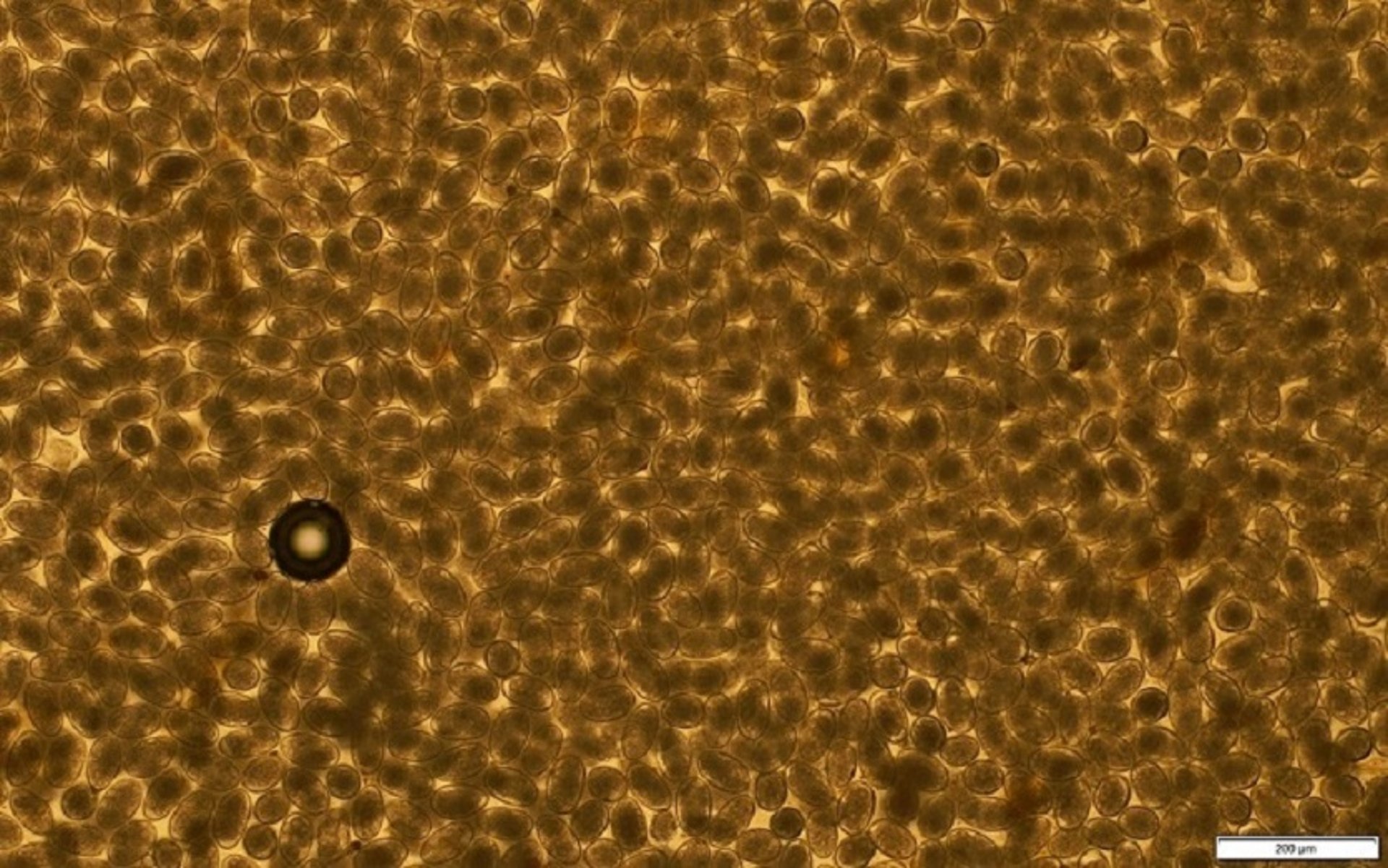Heavy <i >Haemonchus</i> infection, postpartum goat