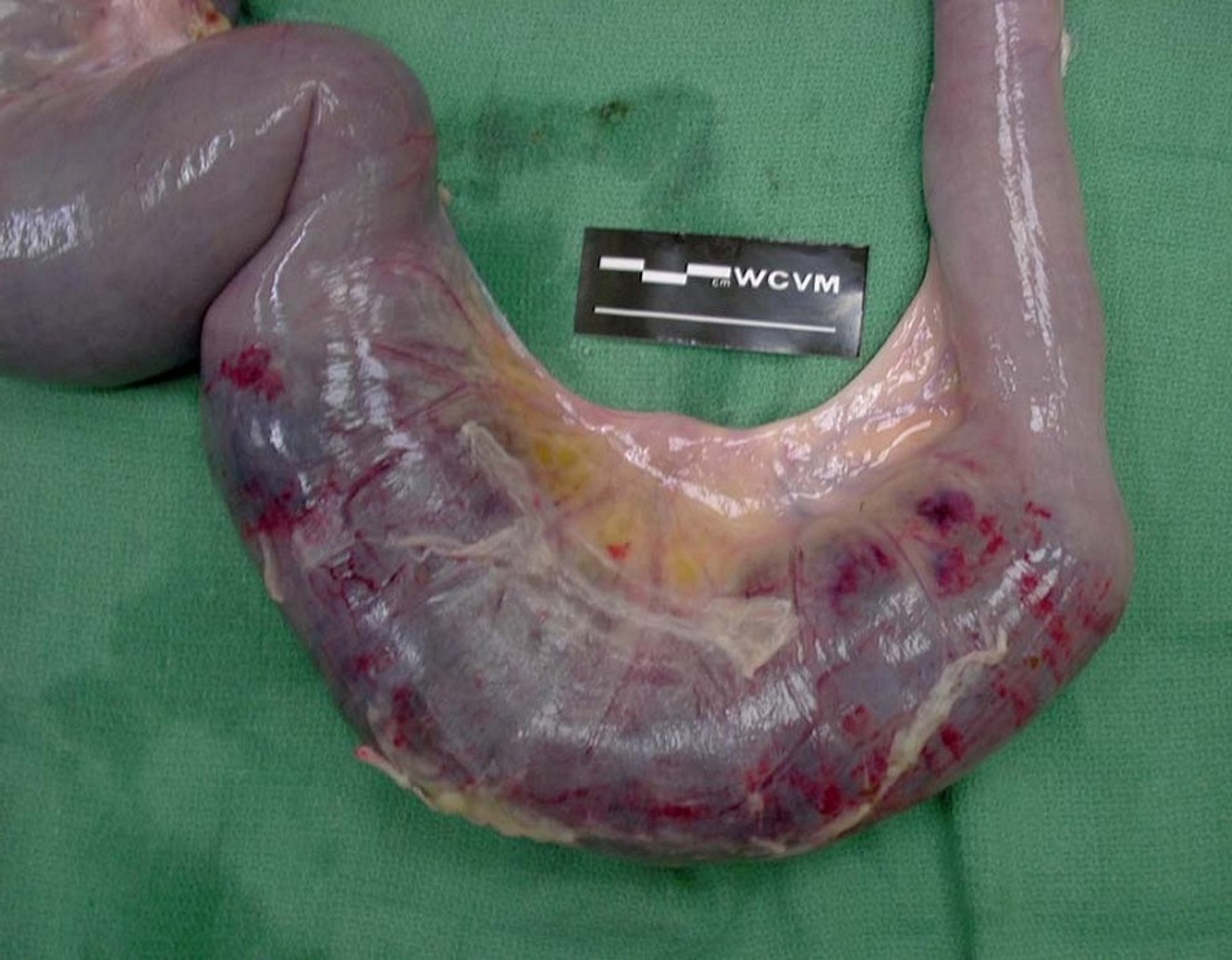 Hemorrhagic bowel syndrome