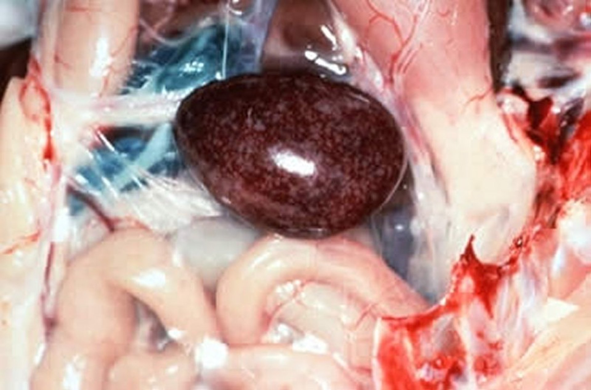 Hemorrhagic enteritis, enlarged spleen, turkey