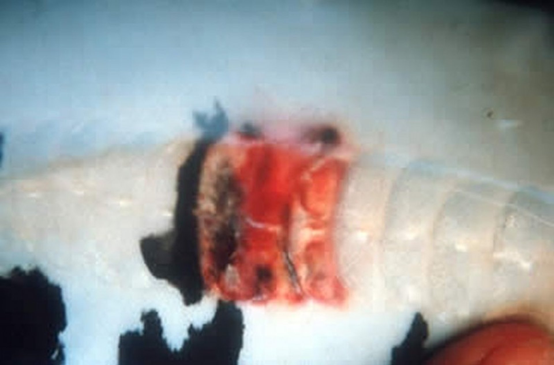 Hemorrhagic ulcer, body wall, koi