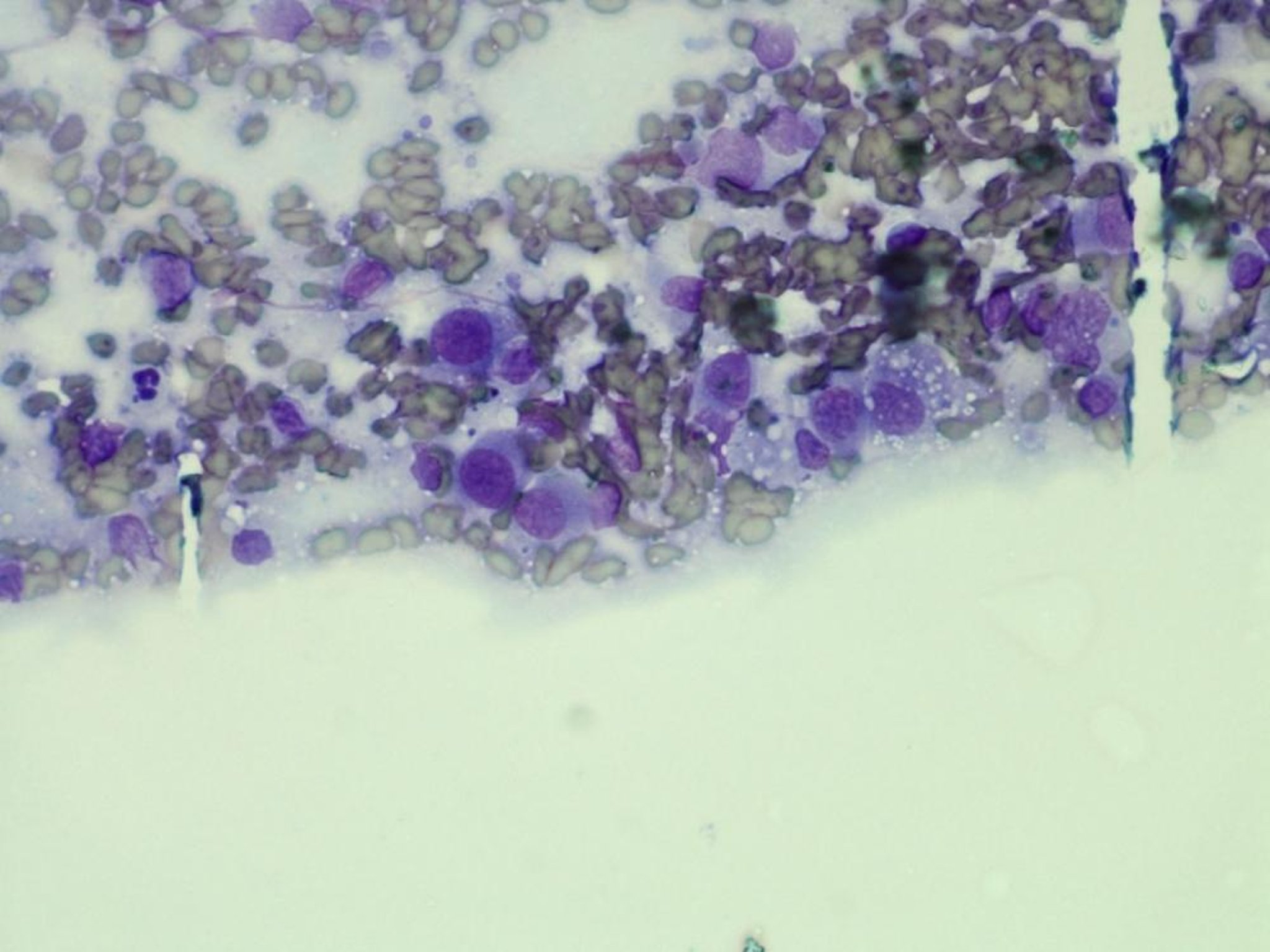 Histiocytoma, cytology