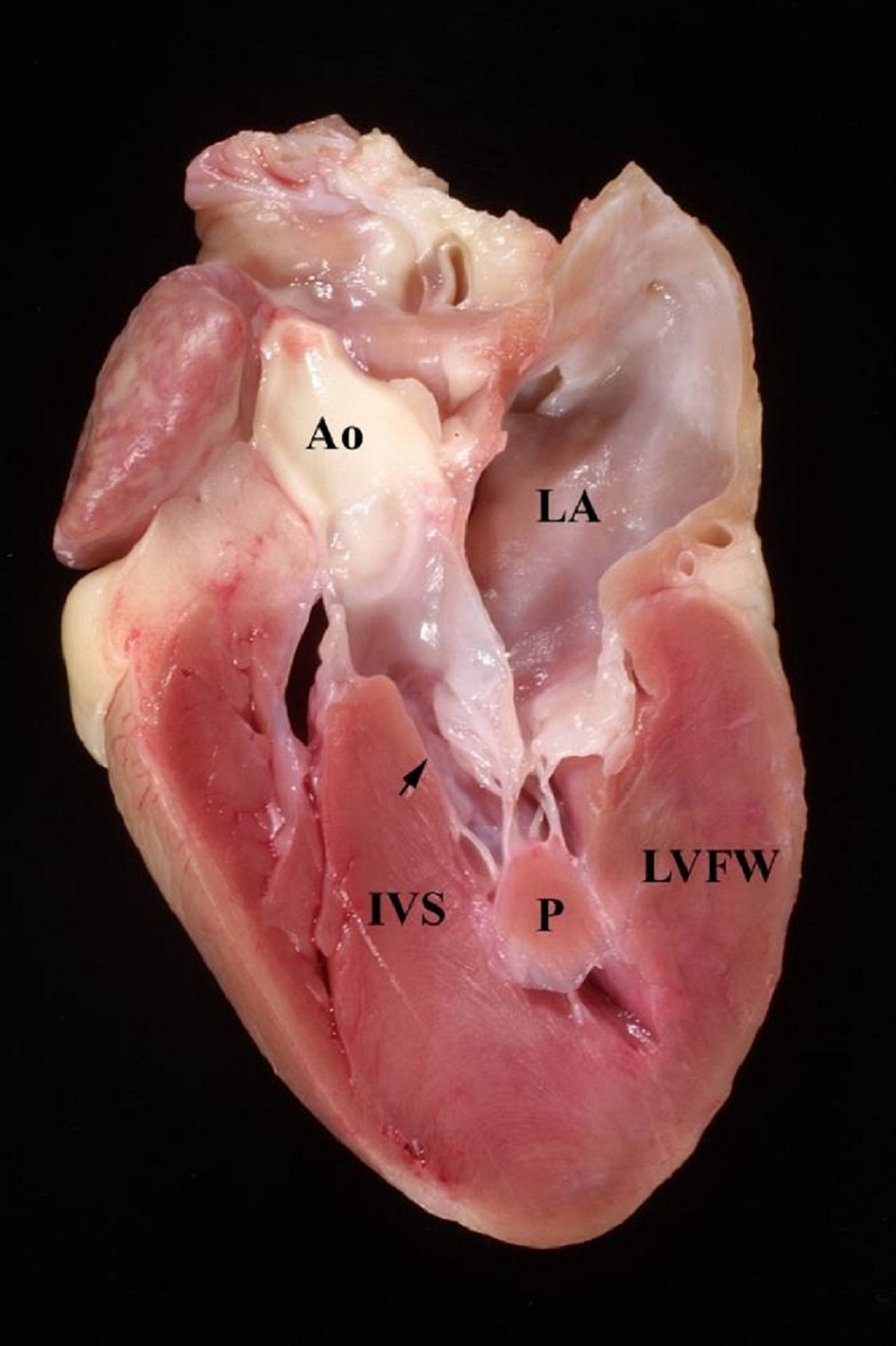 Hypertrophic cardiomyopathy, cat