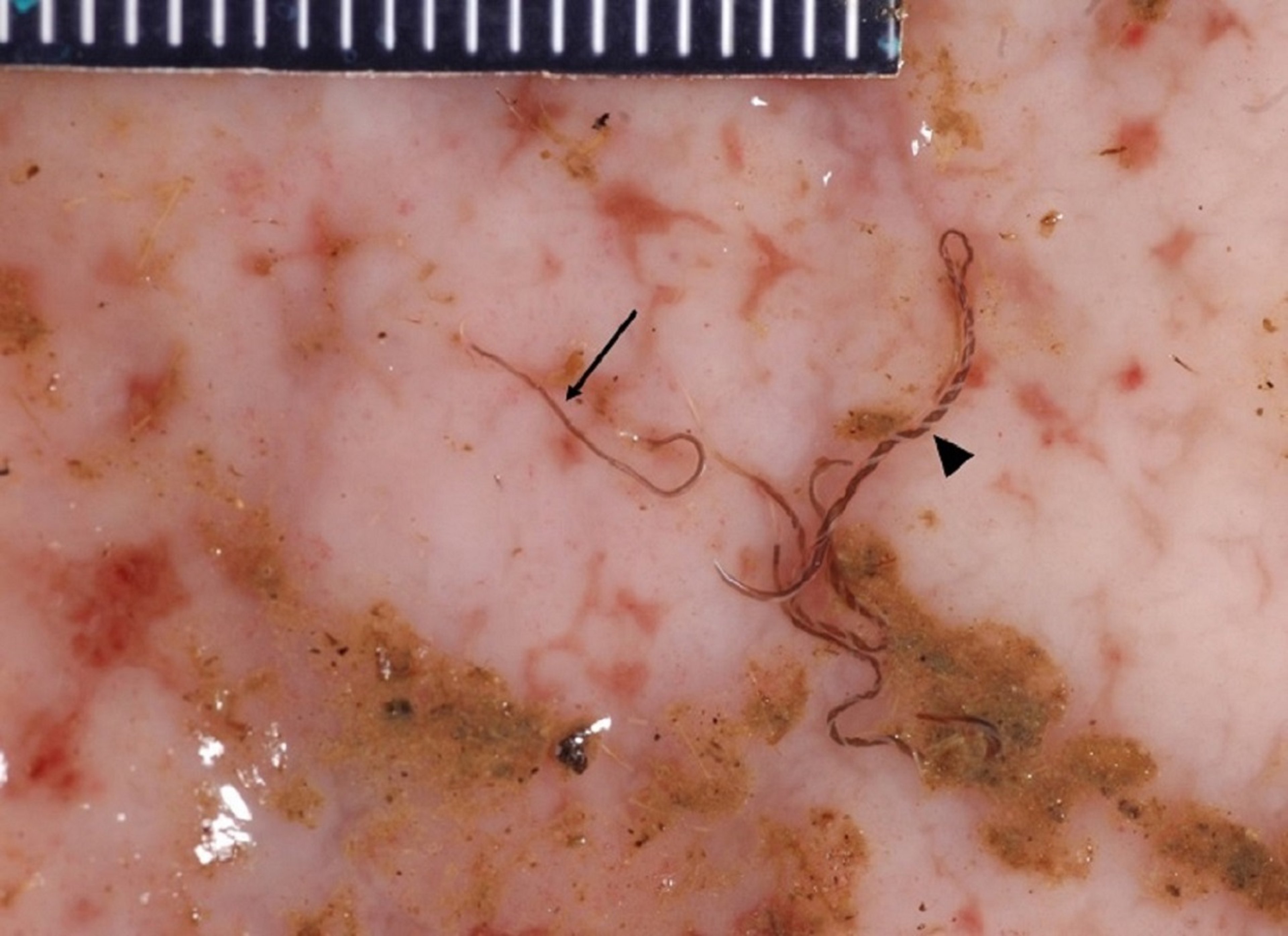 <i >Haemonchus</i> adultos