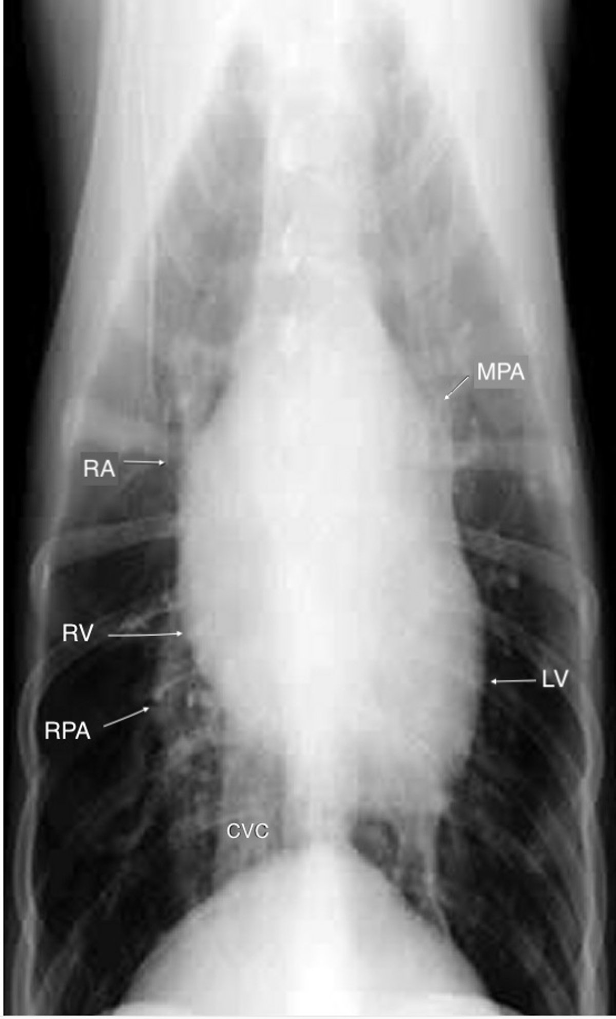 Heartworm disease, mild lesions, ventrodorsal radiograph, dog