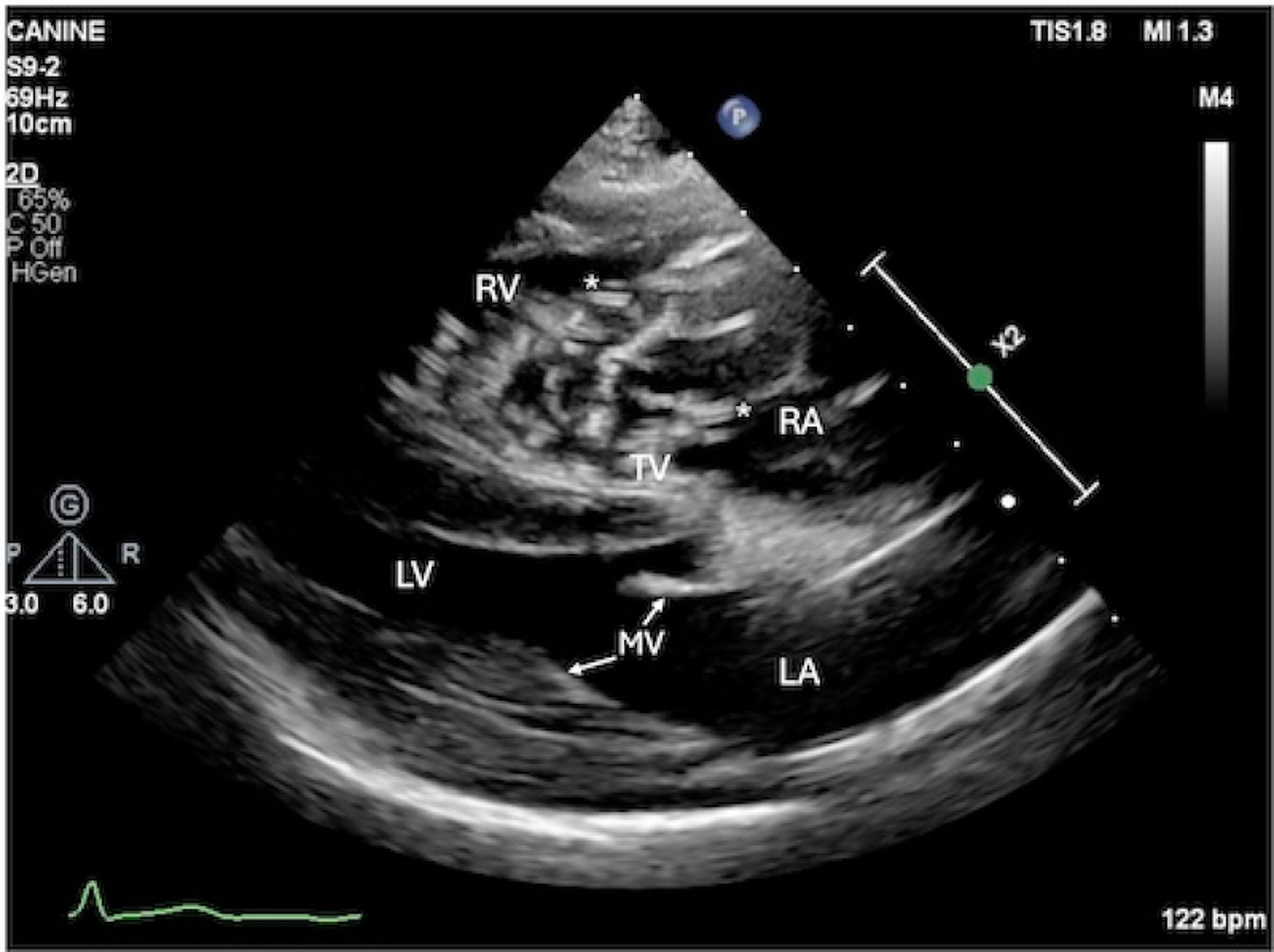 Heartworm disease, echocardiogram, 4-chamber view, dog