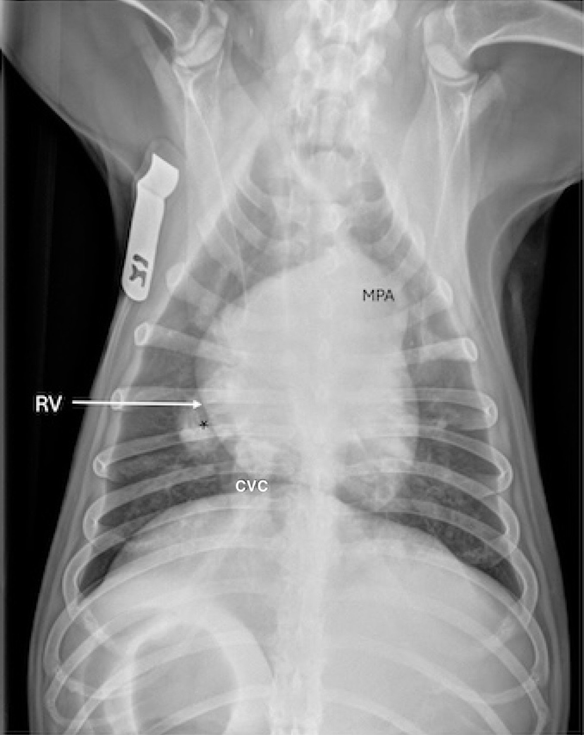 Heartworm disease, severe lesions, ventrodorsal radiograph, dog