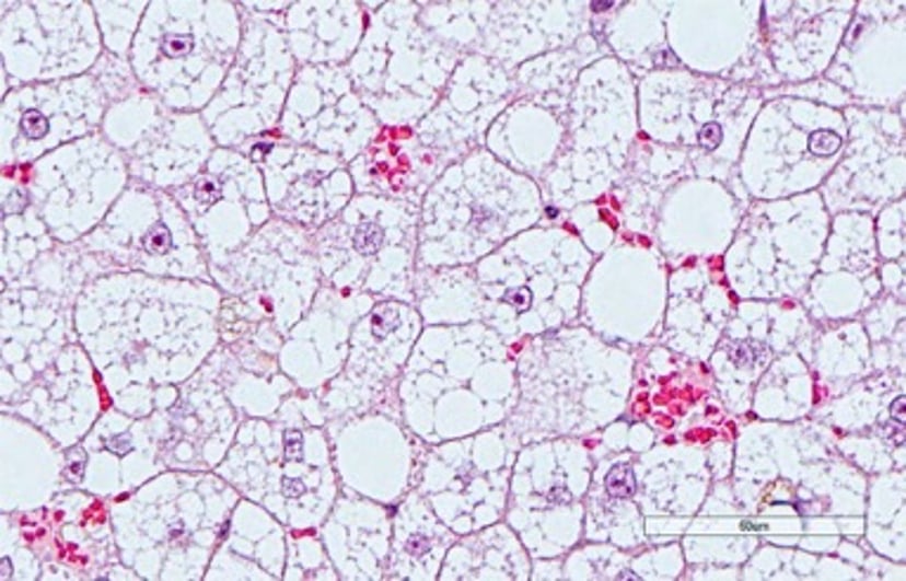 Hepatocyte distension, photomicrograph, cat