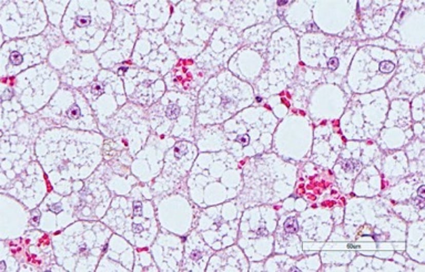 Distensión de hepatocitos, microfotografía, gato