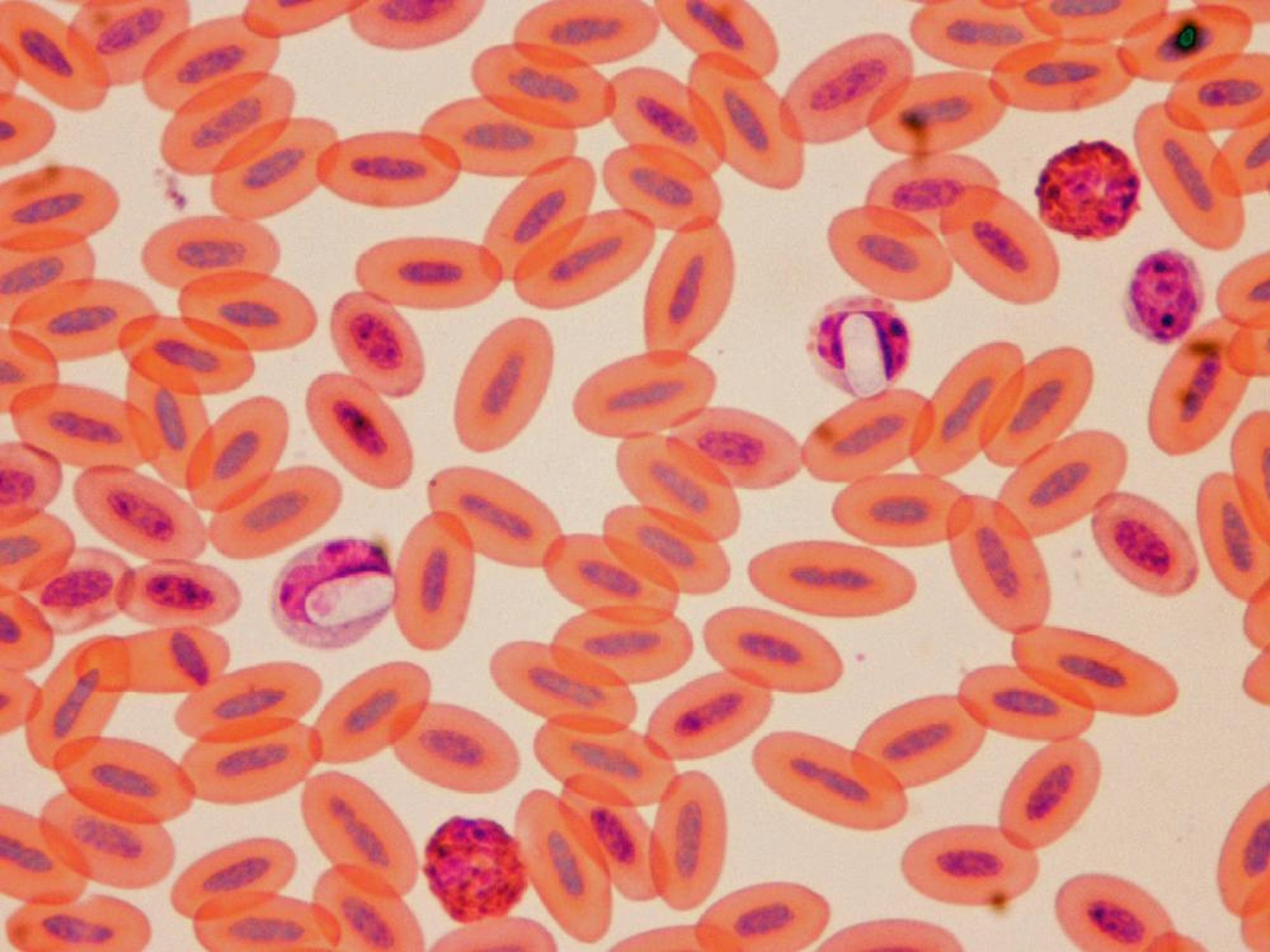Hepatozoon, frotis de sangre, pavo