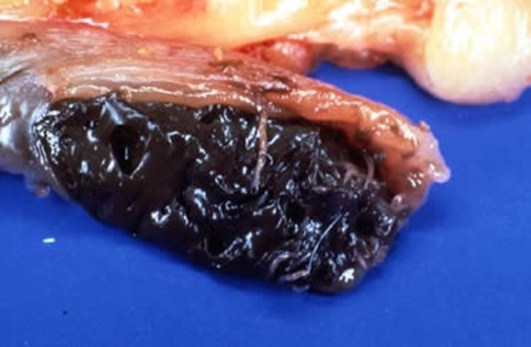 <i >Heterakis gallinarum</i>, bolsas cecales, pollo