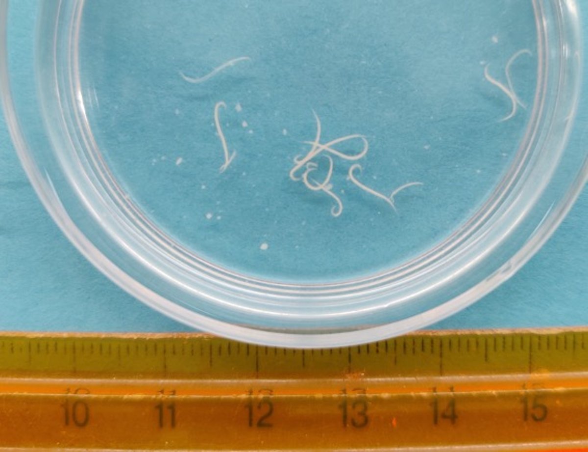 <i >Heterakis gallinarum</i>, pollo