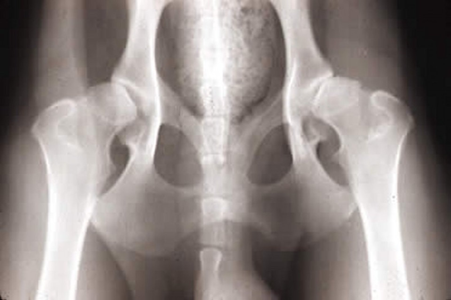 Hip dysplasia, radiograph, dog