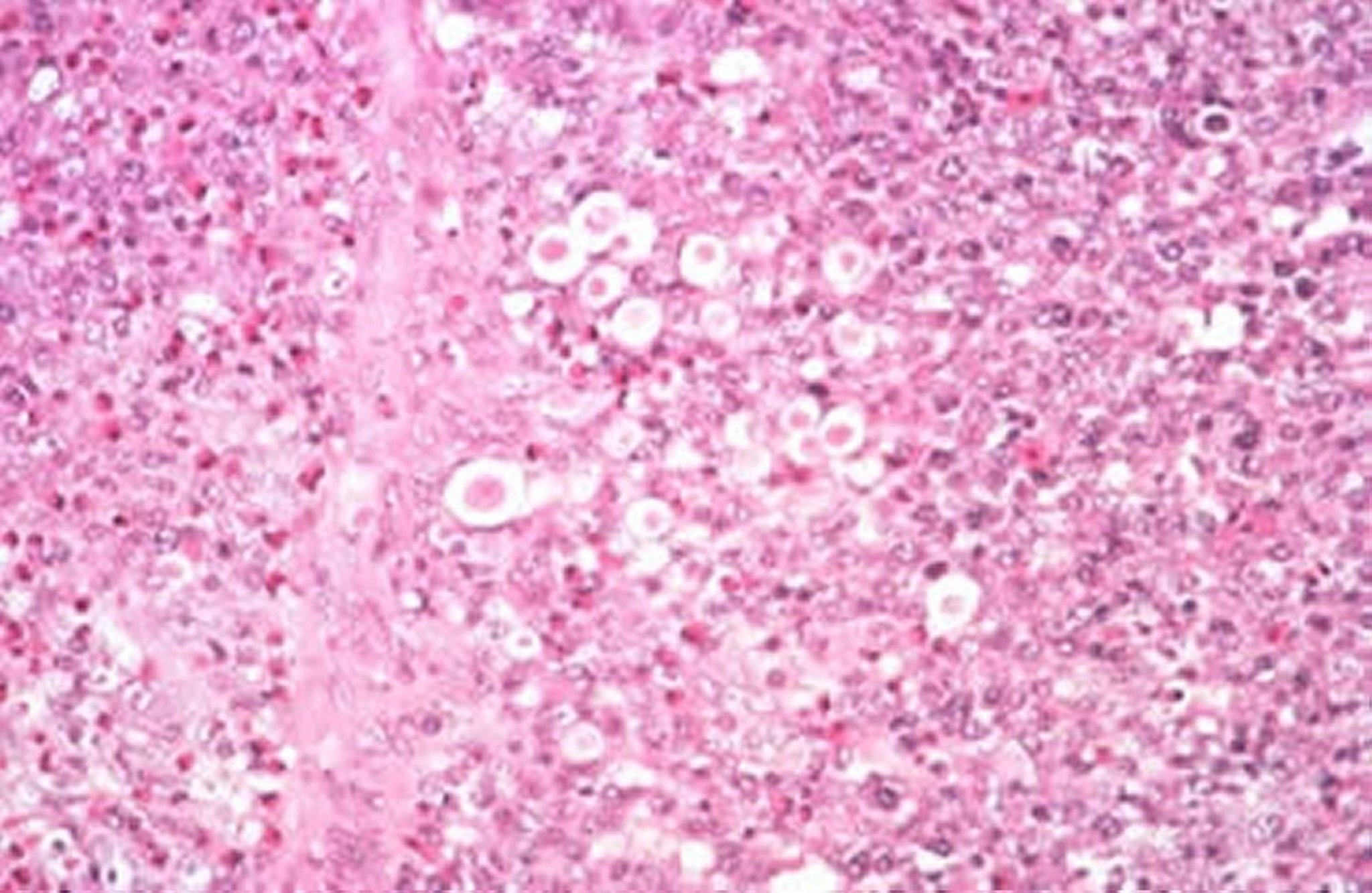 <i >Histomonas meleagridis</i>, liver, turkey