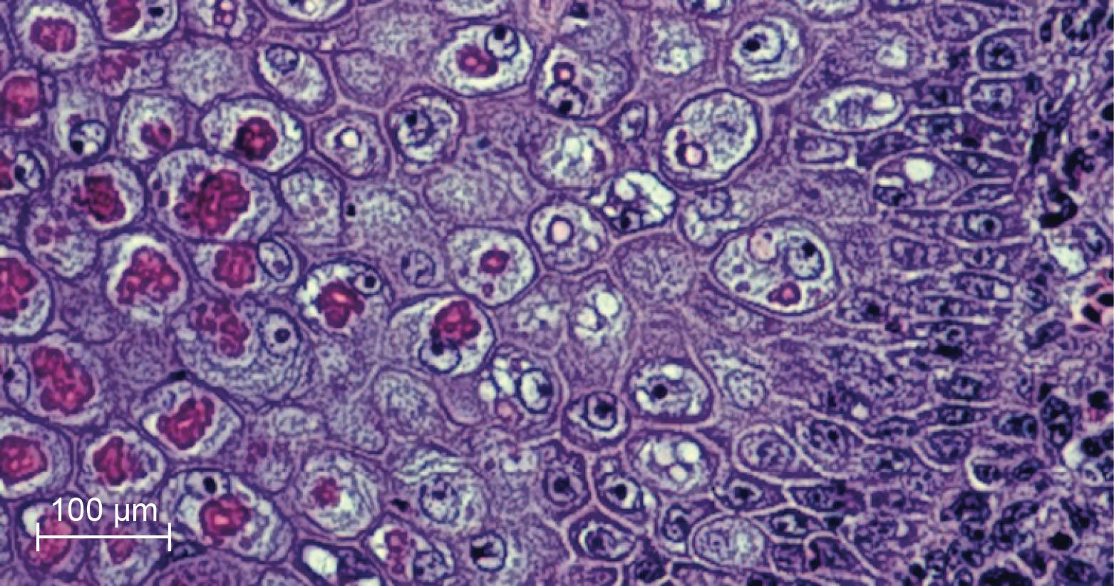 Histopatologia, lesão causada pelo vírus da varíola dos canários