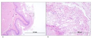 Candidiasis en un buche, gallina ponedora