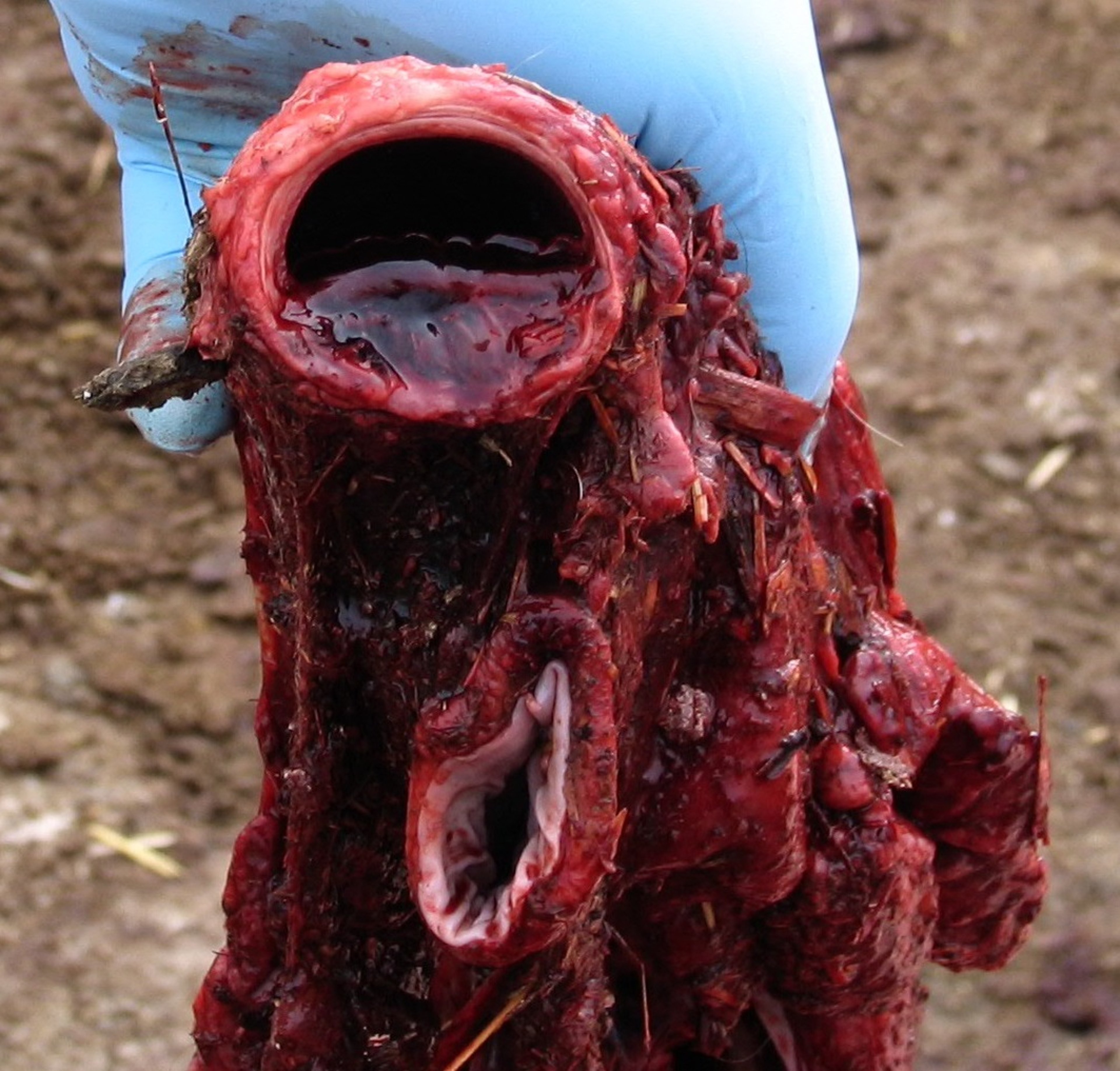 Síndrome de Honker, lesiones anatomopatológicas