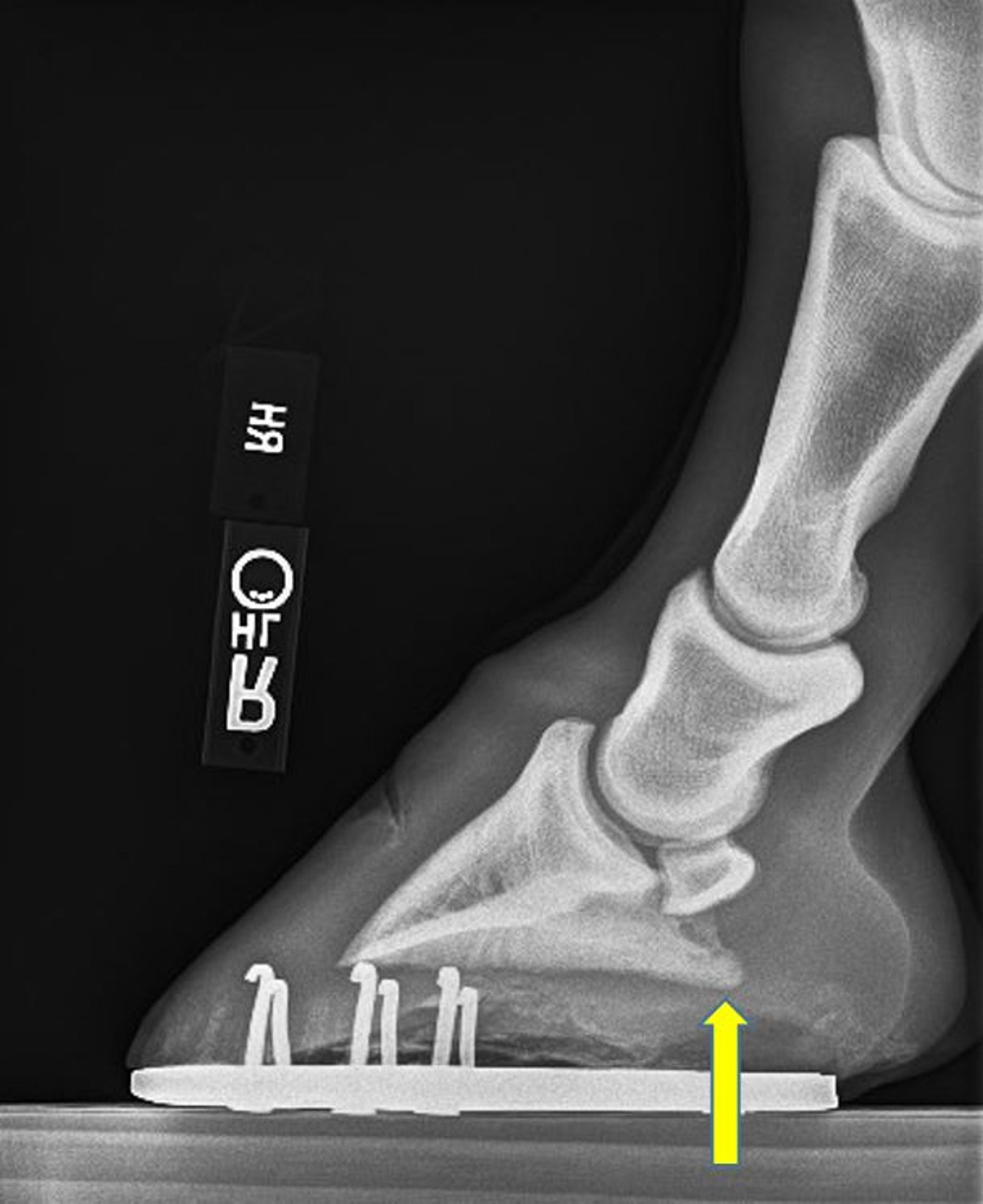 Hoof imbalance, sagittal plane, radiograph, horse