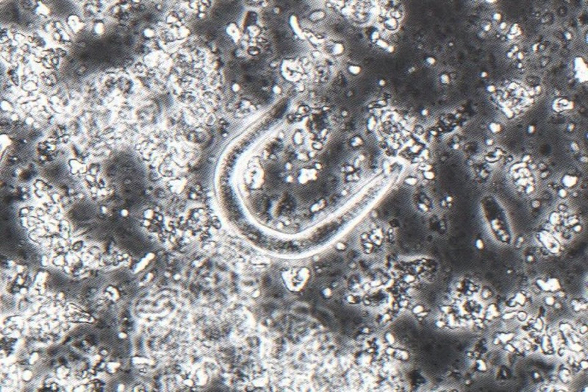Hookworm (<i >Kalicephalus</i> spp) larva, blood python