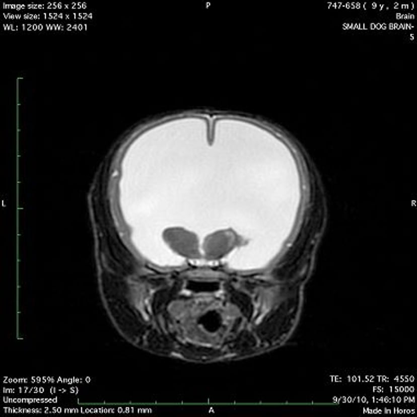 Hydrocephalus, dog, MRI