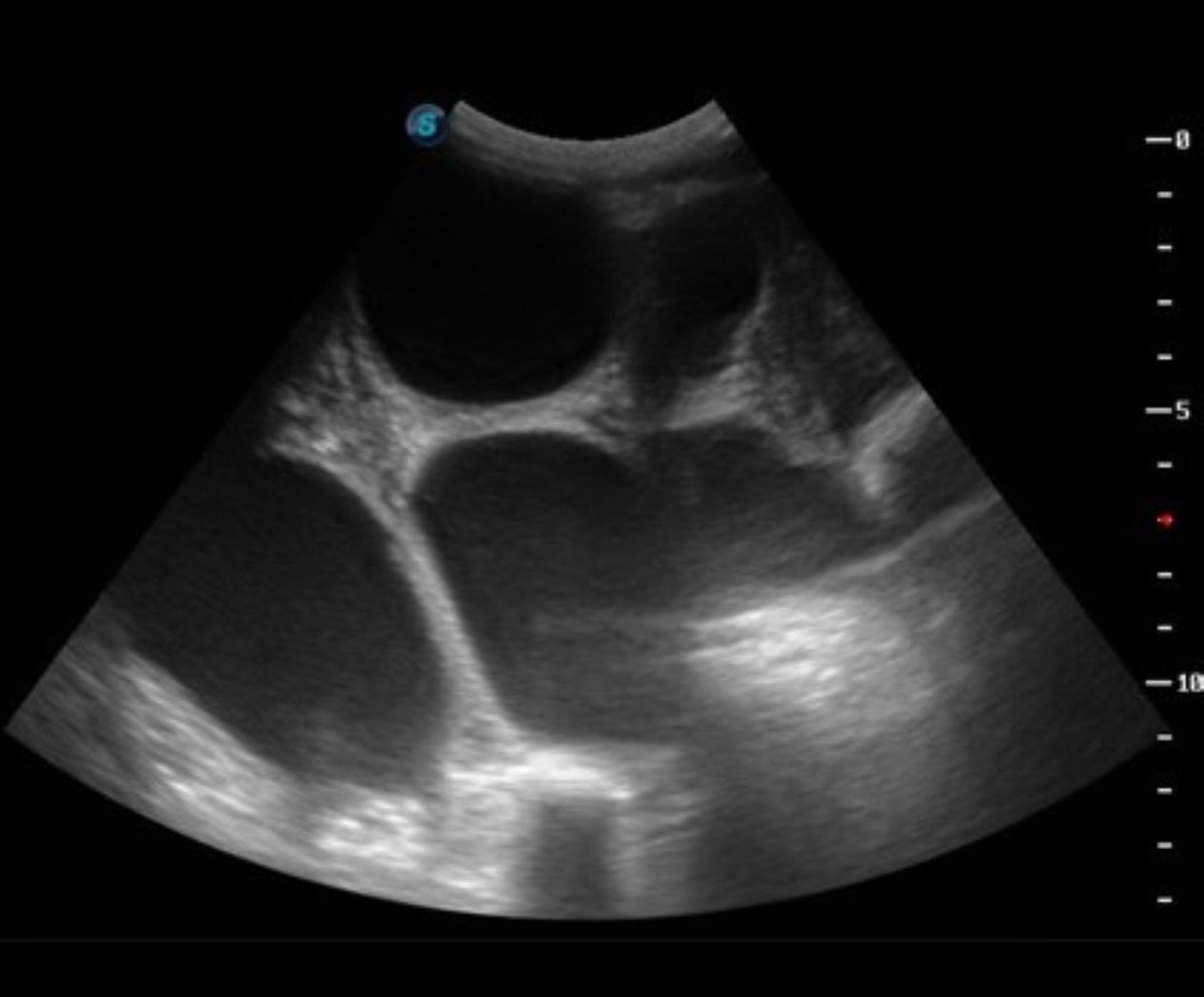 Hydrometra, ultrasonography, goat