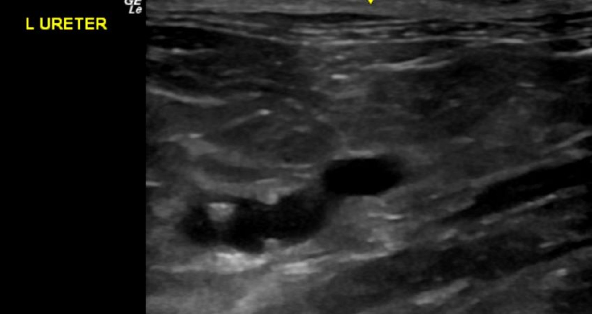 Hydroureter, ultrasonogram, cat