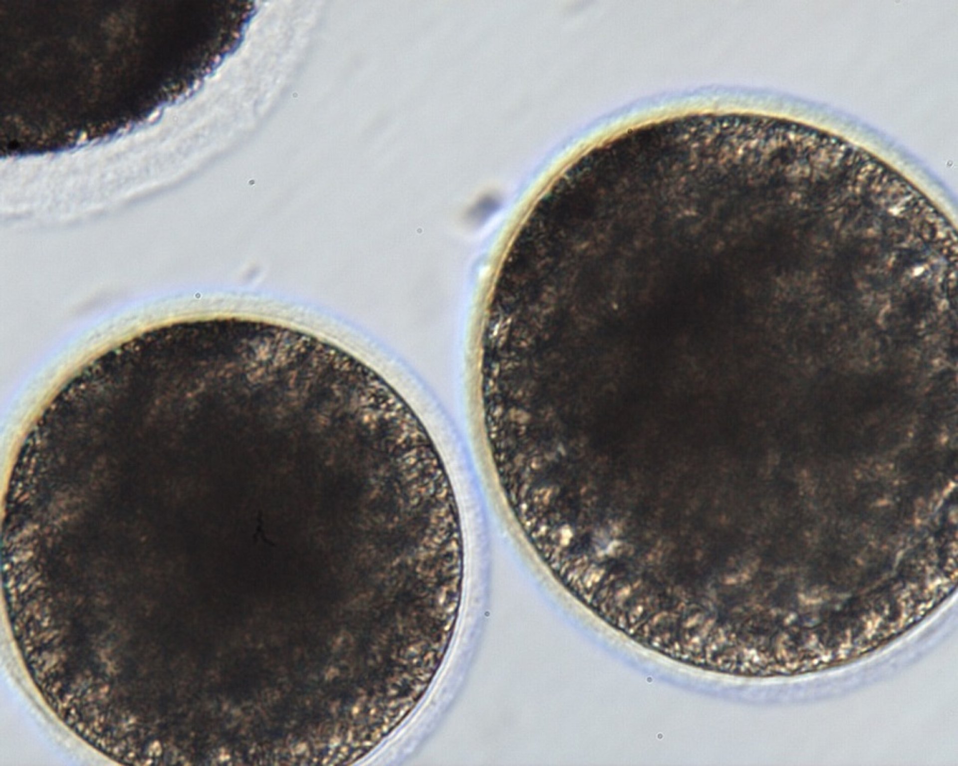 Blastocytes Produced via Intracytoplasmic Sperm Injection