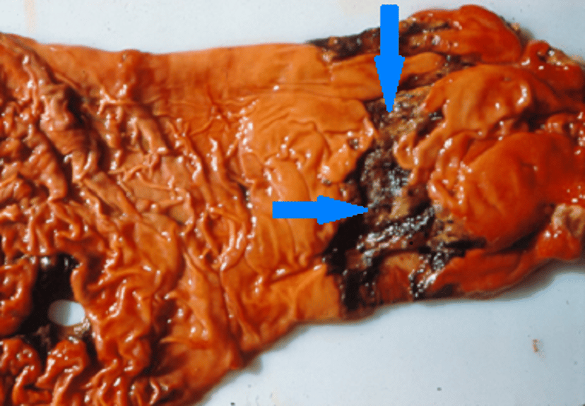 Intestinal perforations, bovine