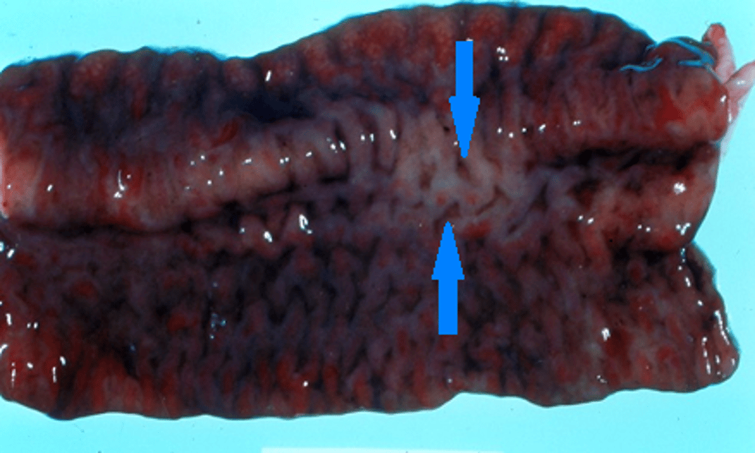 Intestinal ulcers, bovine