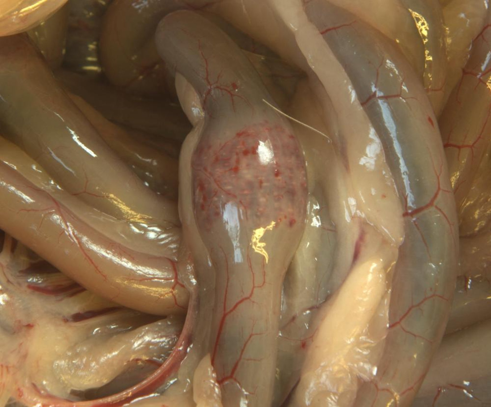 Duck viral enteritis, intestinal annular bands