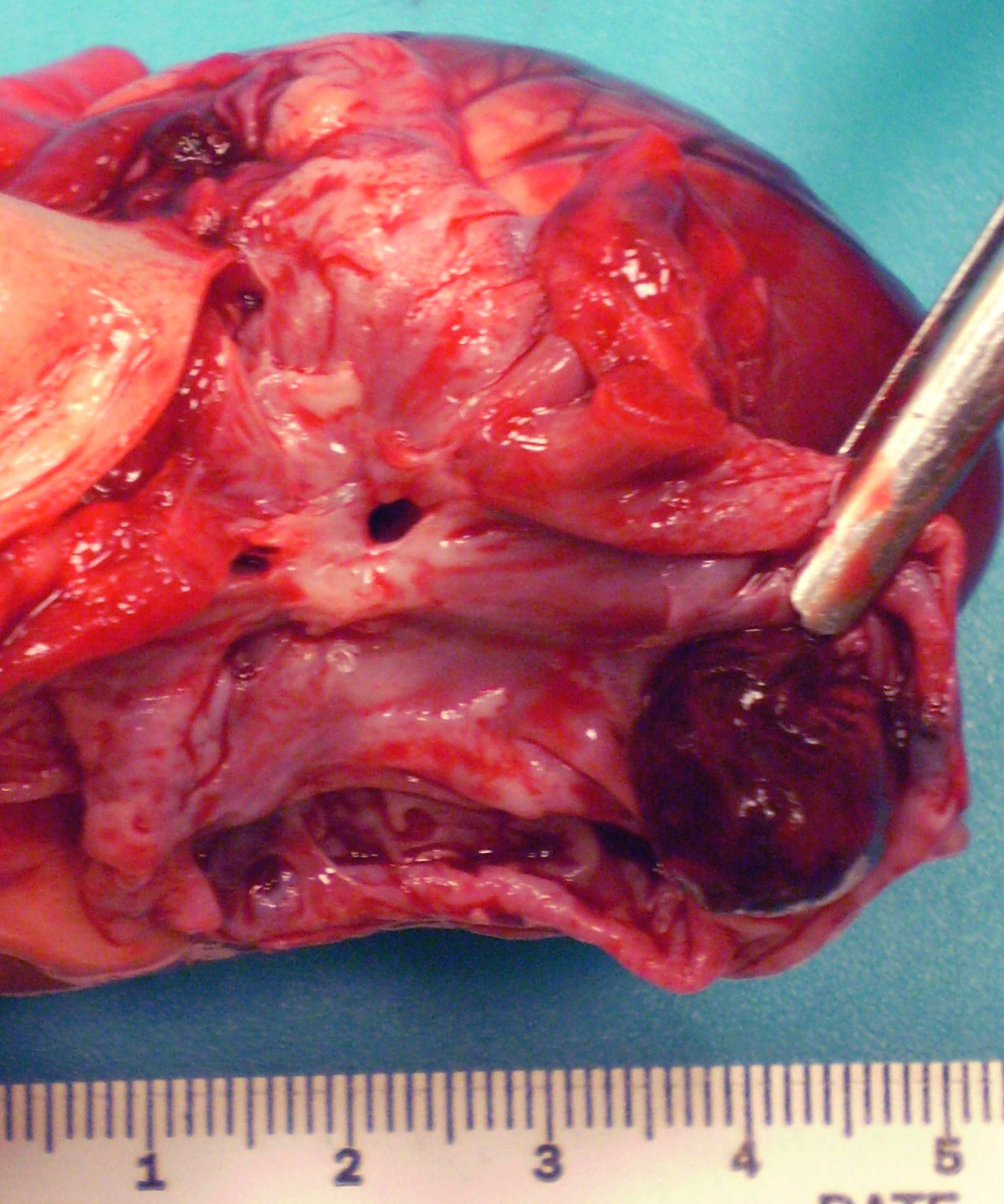 Intracardiac thrombus, cat