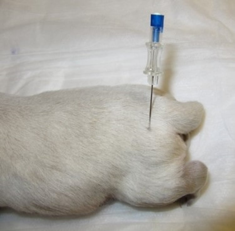 Catheter placement, neonate