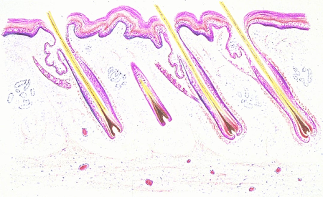 Skin with hair