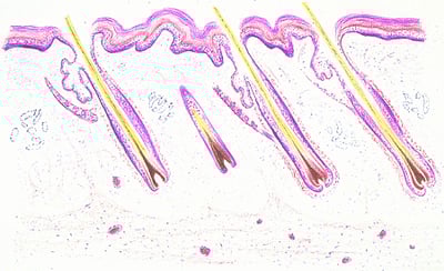 Skin with hair