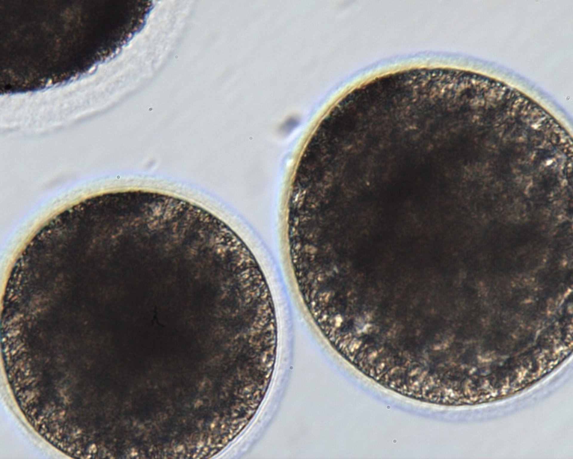 Blastocistos producidos por inyección intracitoplasmática de espermatozoides
