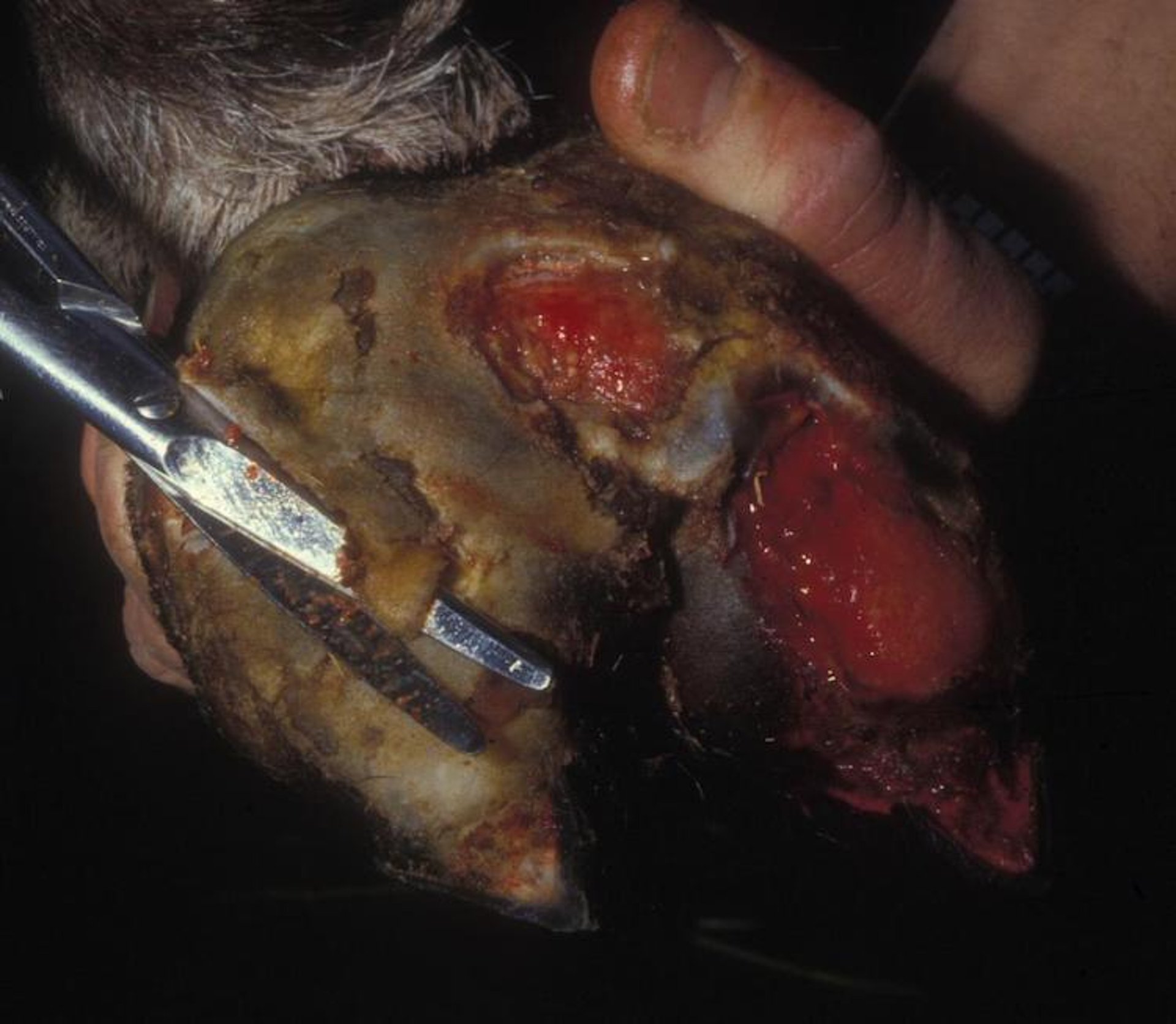 Immersion foot, llama