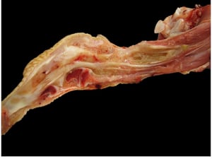 Infectious synovitis (Mycoplasma synoviae) with exudate, turkey