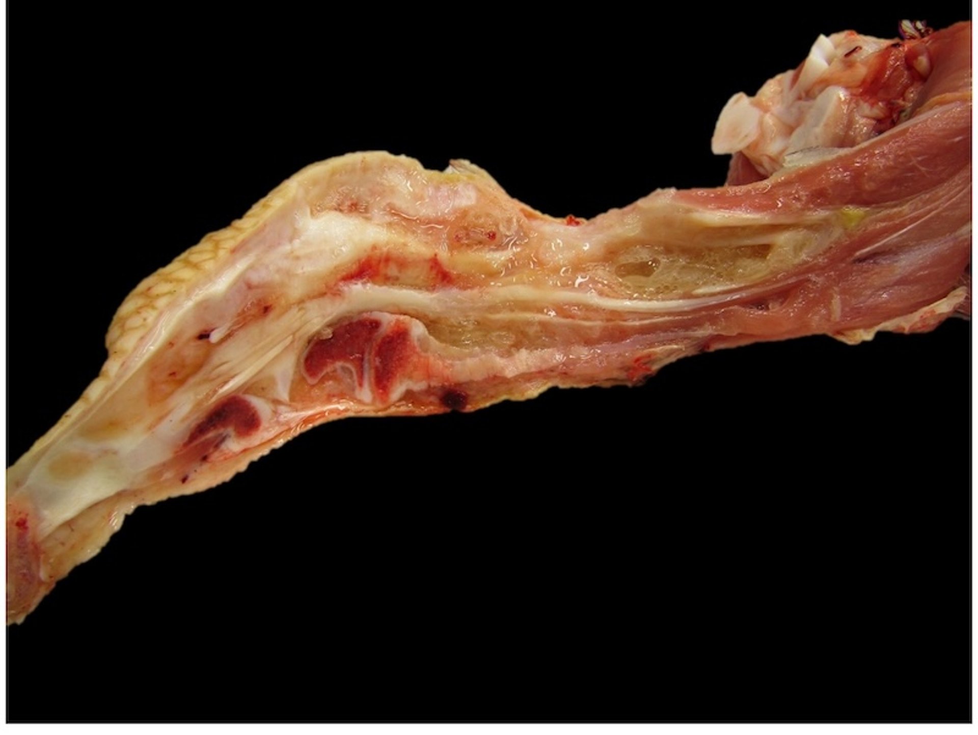 Sinovitis infecciosa (<i >Mycoplasma synoviae</i>) con exudado, pavo