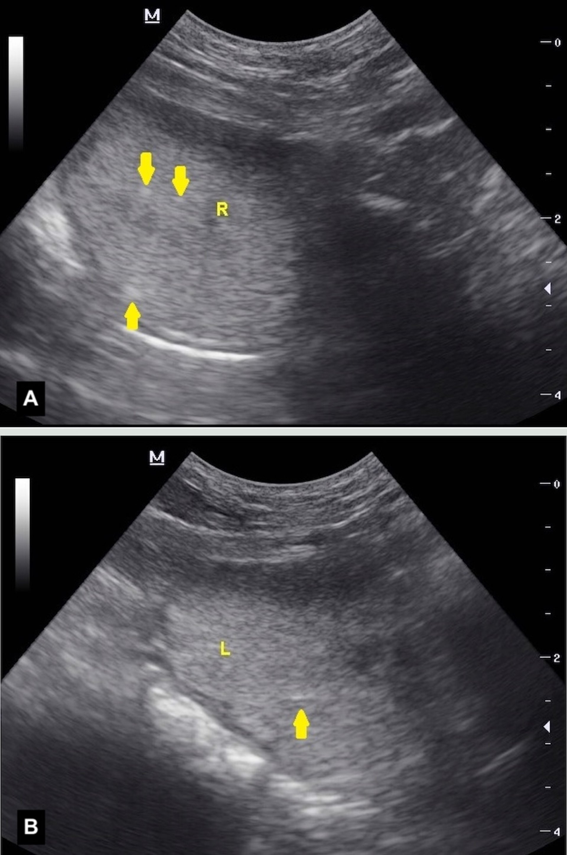 Inflamación, próstata, ecografía transabdominal, perro