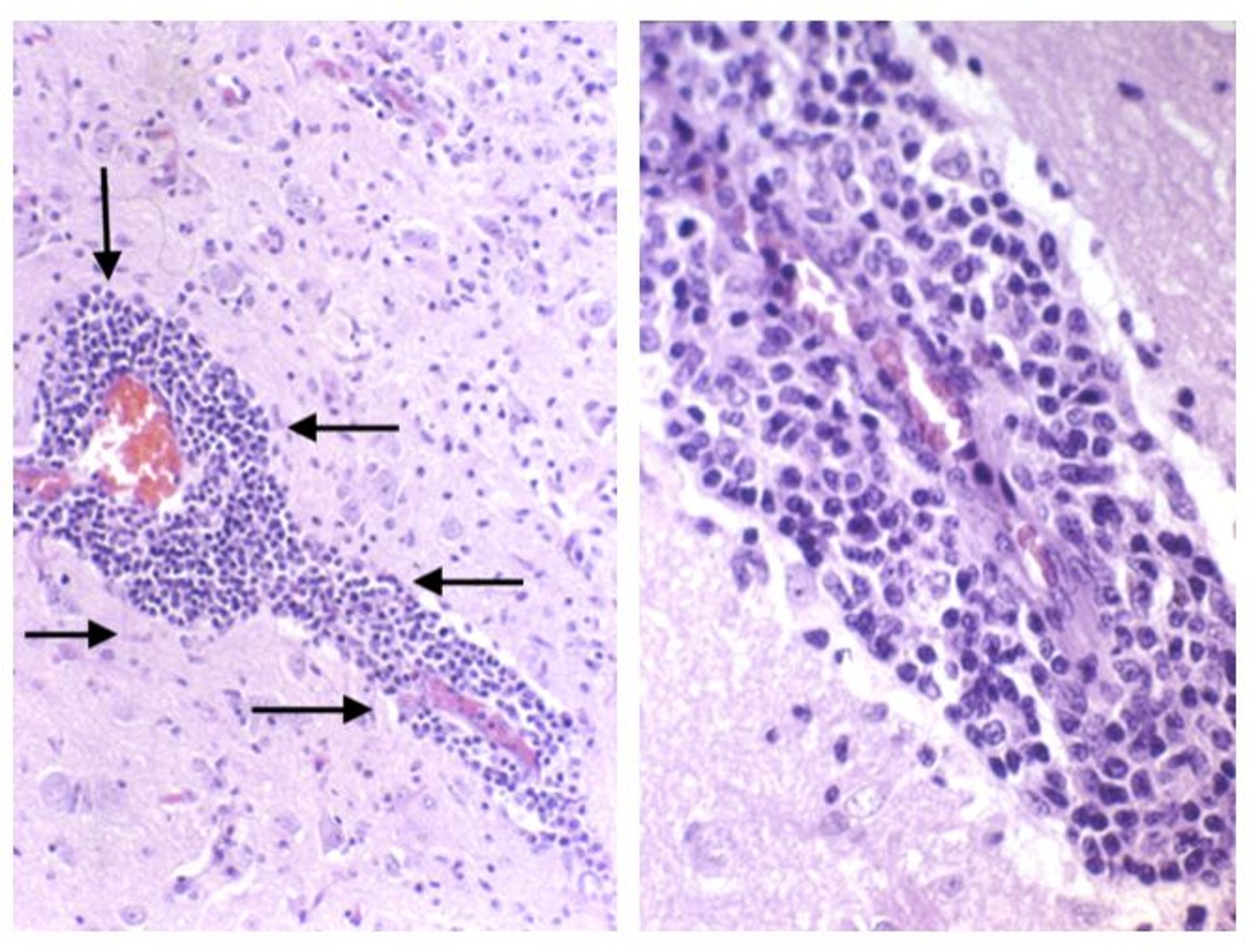 Inflammatory cells, brain, dog, photomicrographs