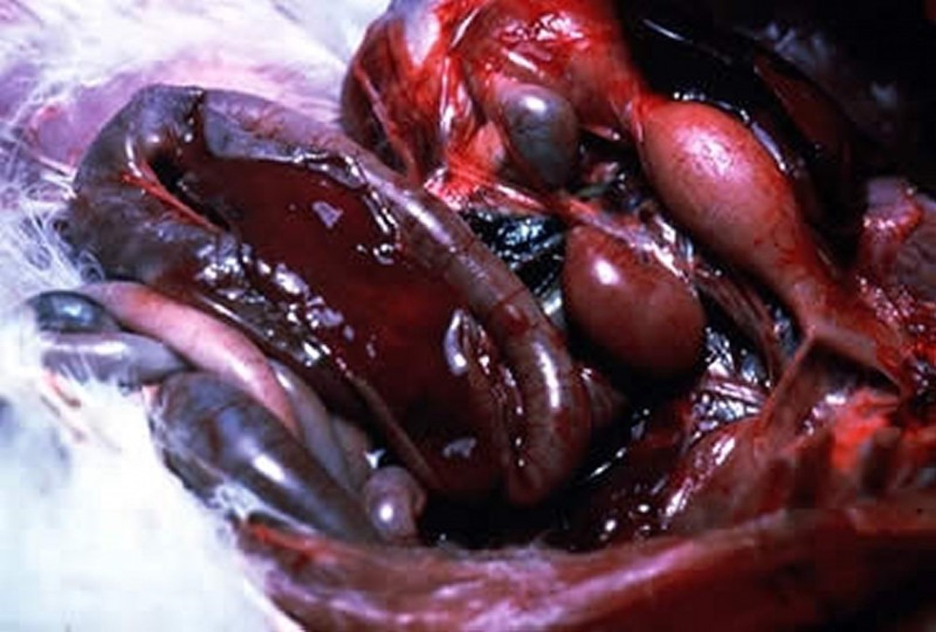 Enteritis hemorrágica, hemorragia intestinal, pavo