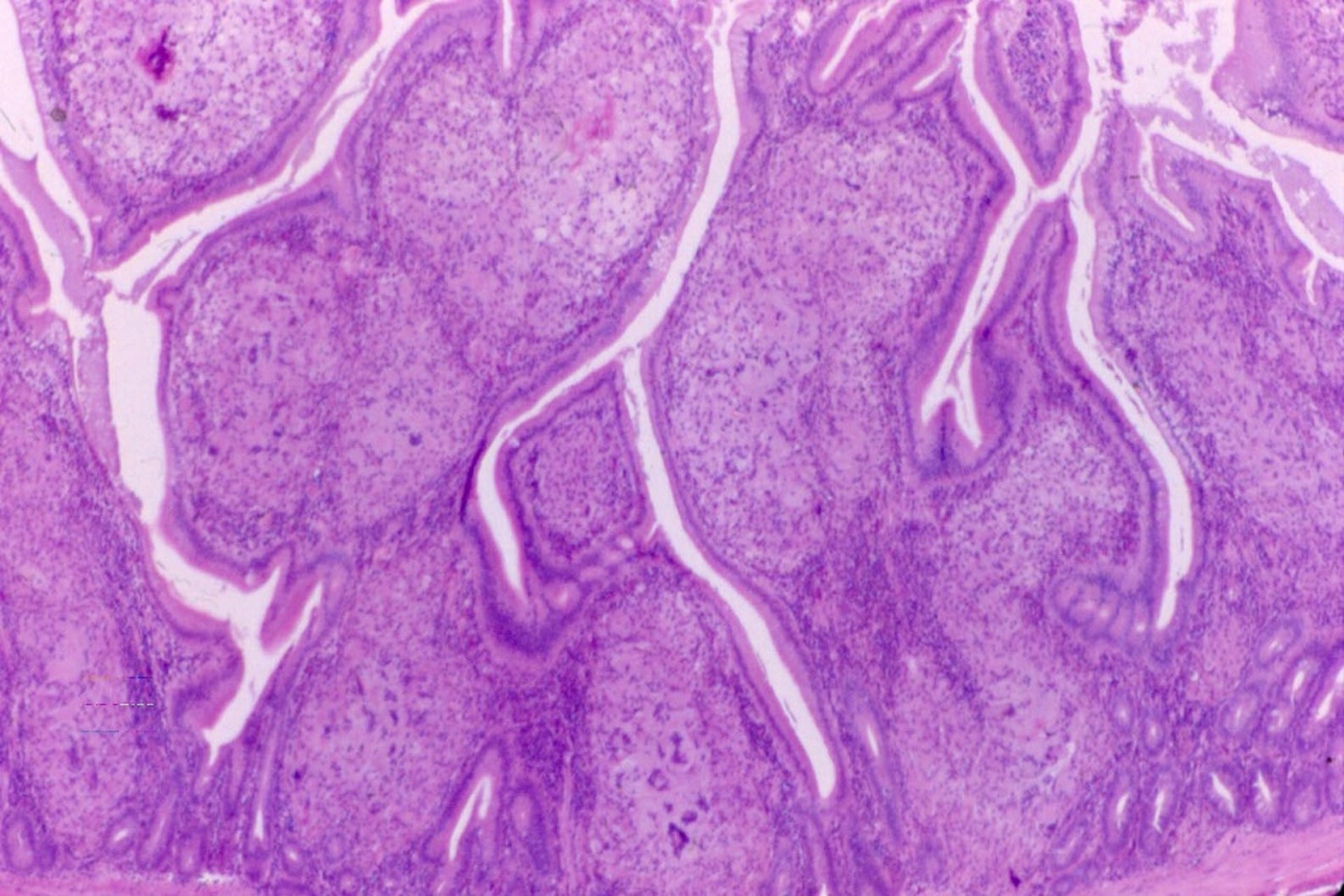 Intestinal lamina propria, tuberculosis, poultry