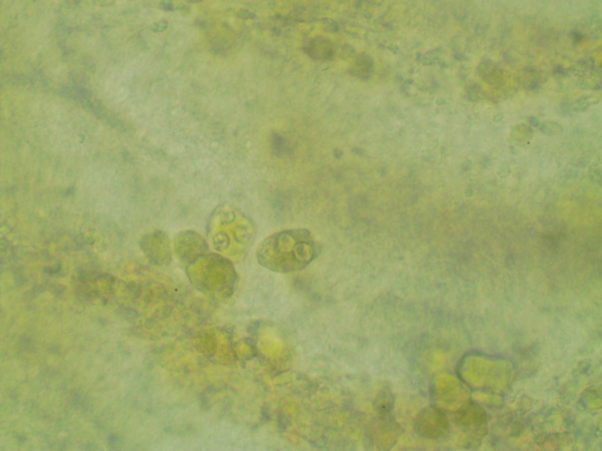 Preparación en fresco sin teñir de coccidios, intestino de un carpín dorado