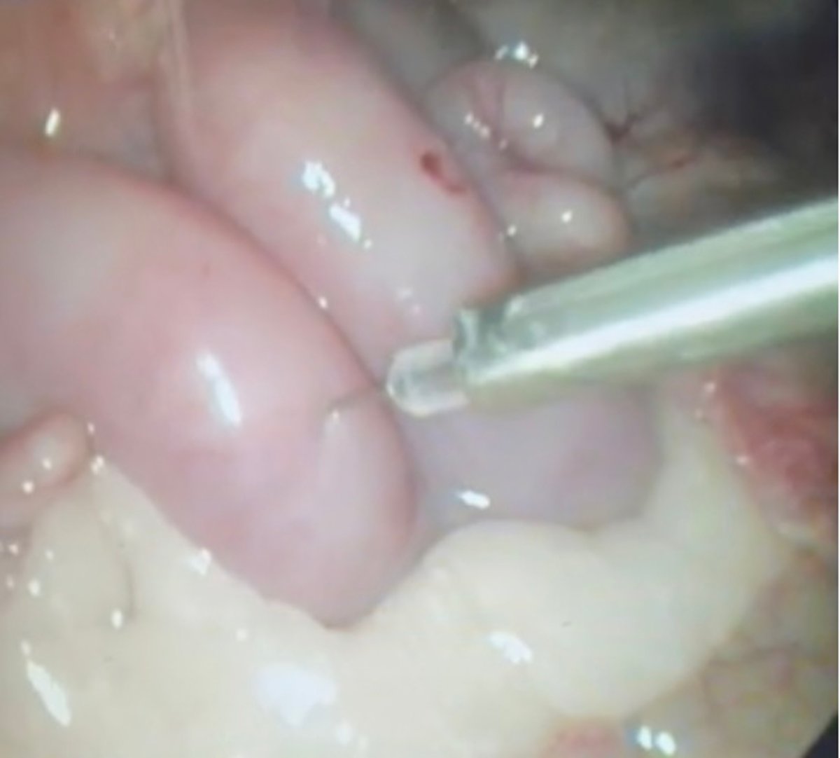 Intrauterine laparoscopic insemination, ewe