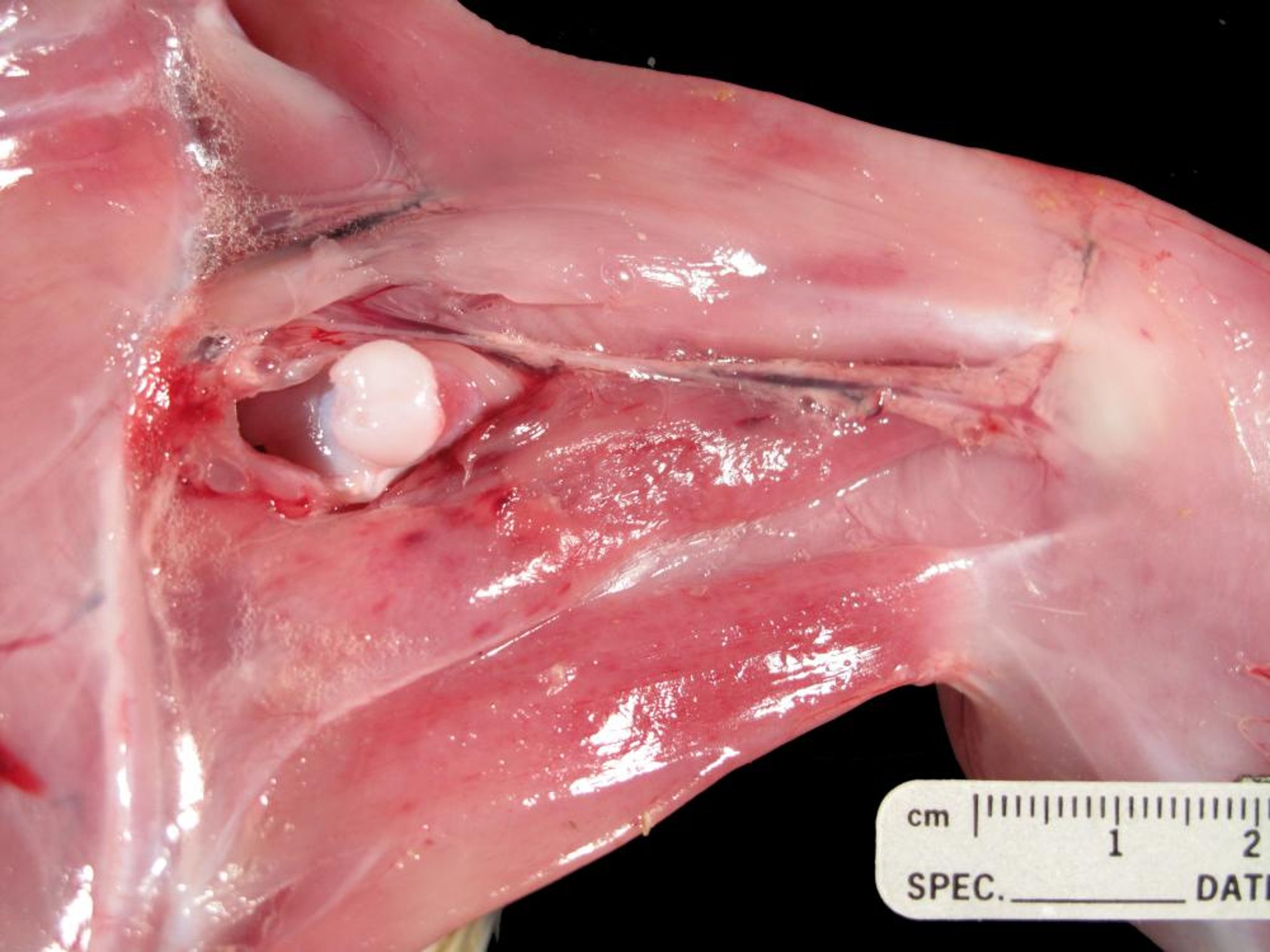 Ionophore toxicosis, myodegeneration, turkey