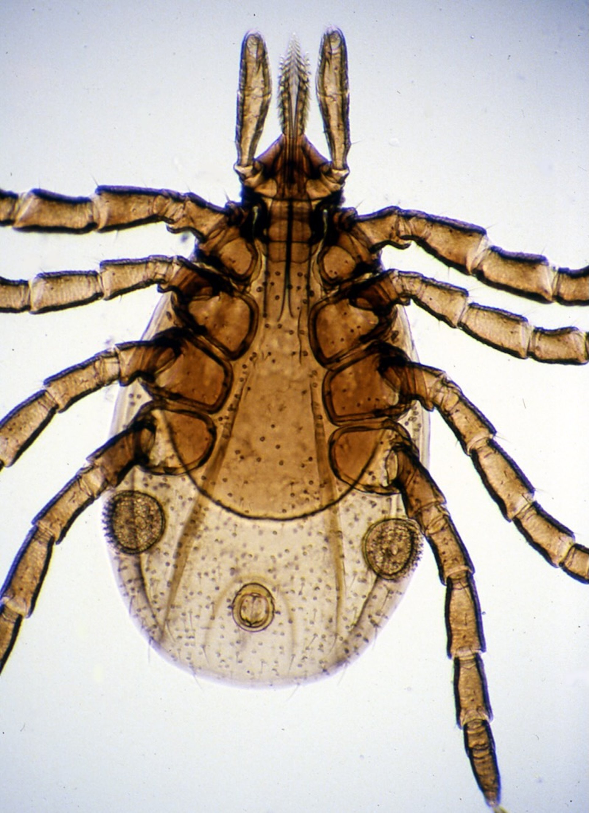 <i >Ixodes scapularis</i>, photomicrograph