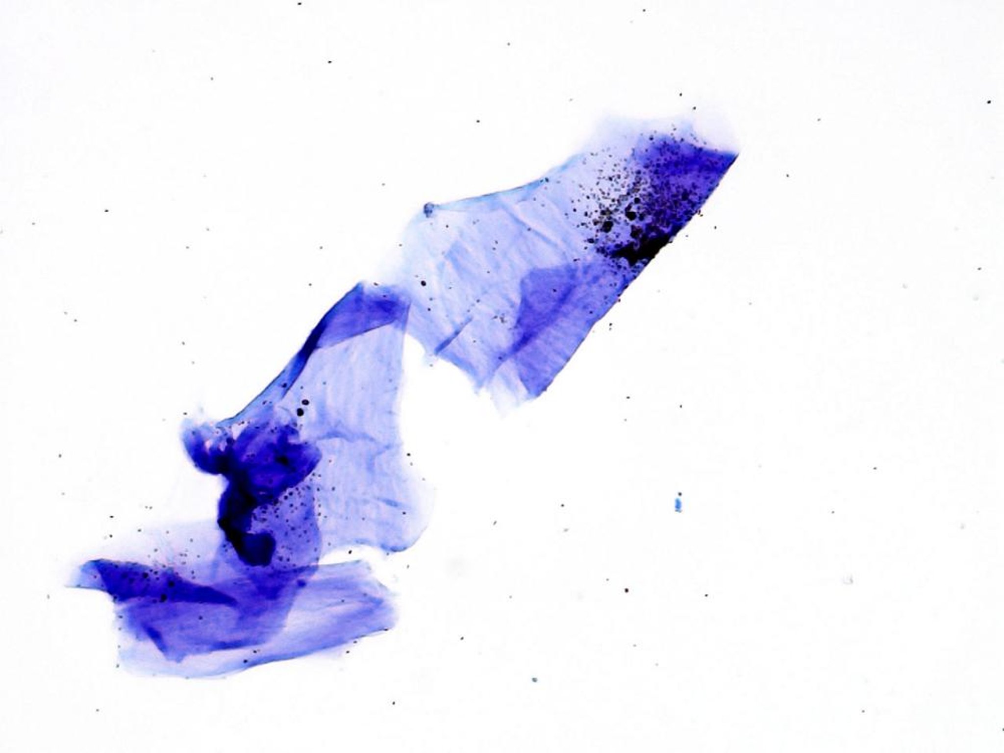 Keratin, cytology